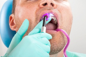 dentist bonding a patient’s teeth