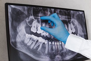 Dentist reviewing a patient’s X-ray