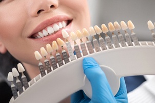 dentist matching the color of porcelain veneer 