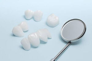 Dental restorations