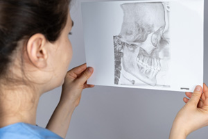 A TMJ disorder is a painful condition that occurs in the temporomandibular joints of the jaw